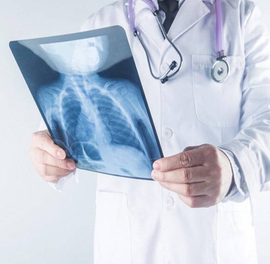 Advanced Digital X-Ray (DR System)